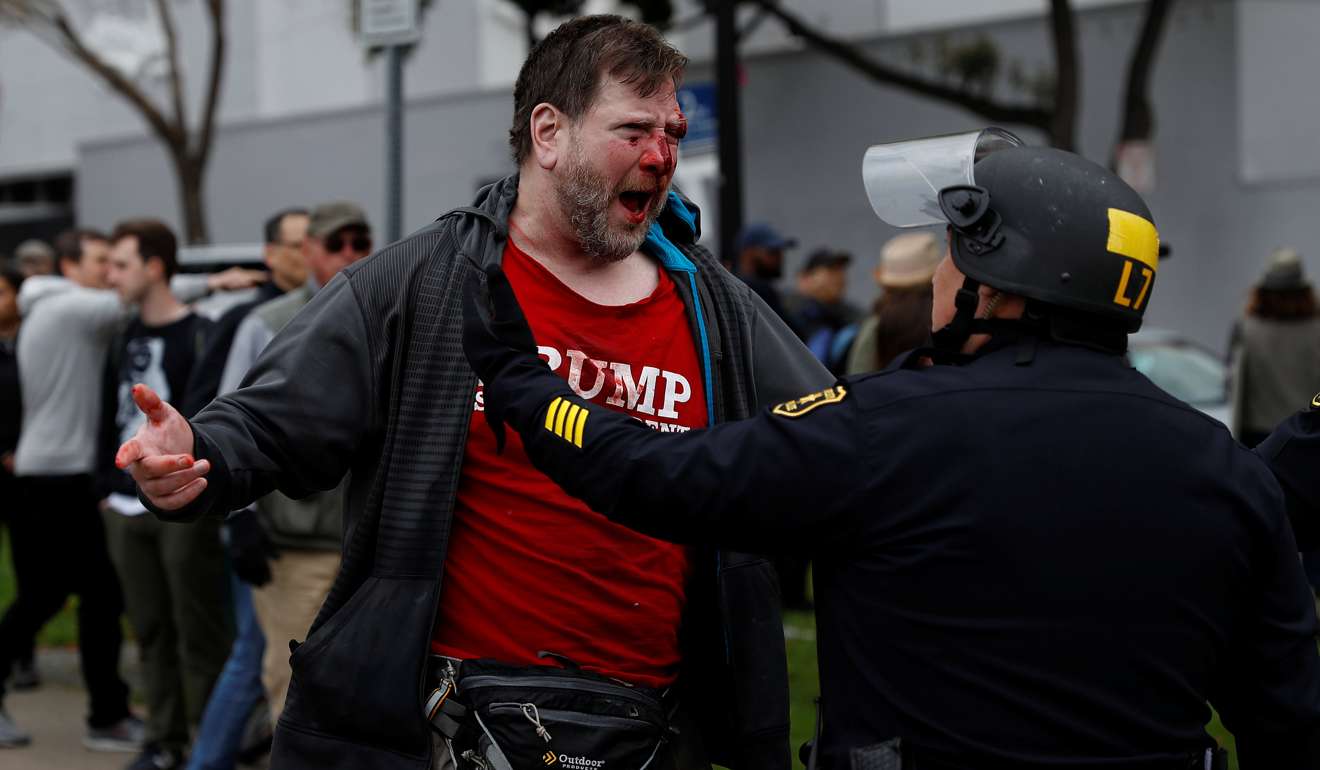 A bloodied supporter of US President Donald Trump is seen after a ‘People 4 Trump’ rally and counter-protest turned violent in Berkeley, California. Photo: Reuters