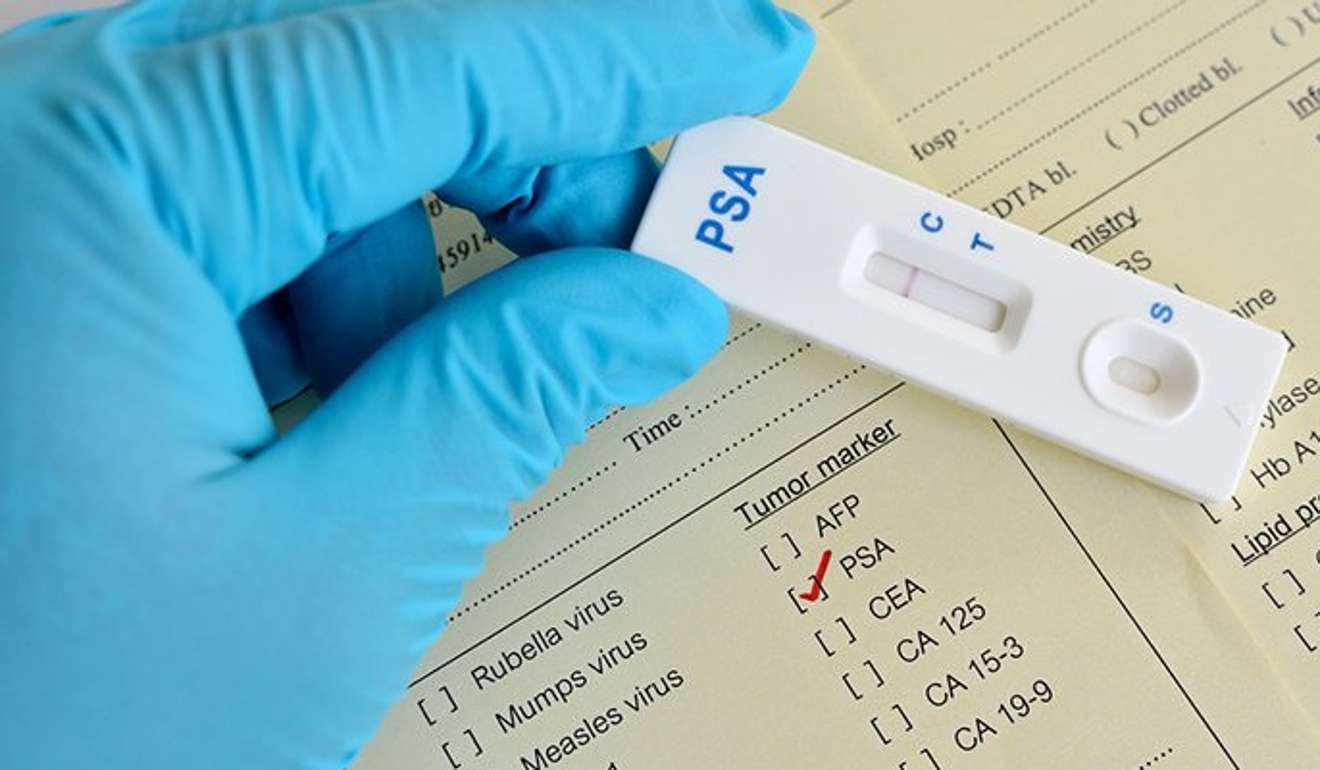 The PSA test for prostate cancer may do as much harm as it does good. Photo: Life Extension
