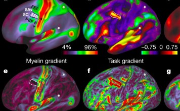 The newly published map divides the brain up into 180 unique brain regions, of which 97 have never been identified before. Photo: Nature Neuroscience