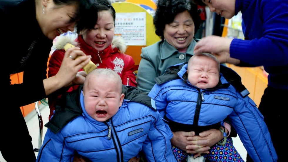 Bald asian girls