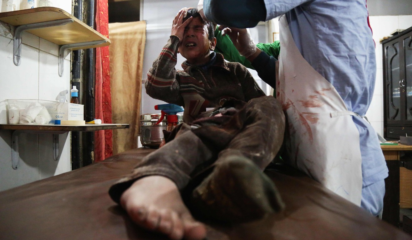 Ghaith, a wounded 12-year-old Syrian boy, cries as he receives treatment at a makeshift hospital in the besieged Eastern Ghouta region of Syria on Monday. Photo: Agence France-Presse