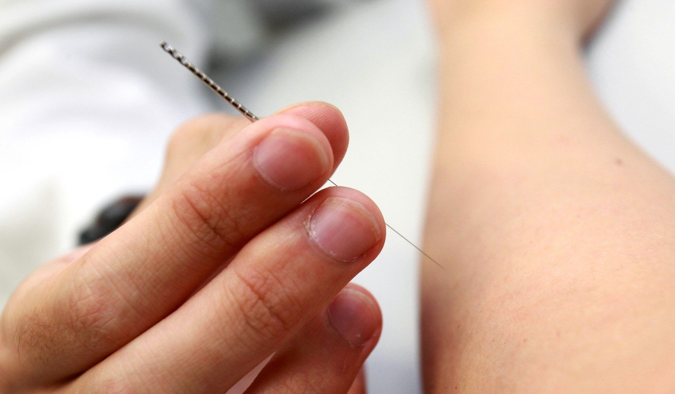 despite-claim-by-acupuncture-specialists-it-does-not-improve-ivf-live