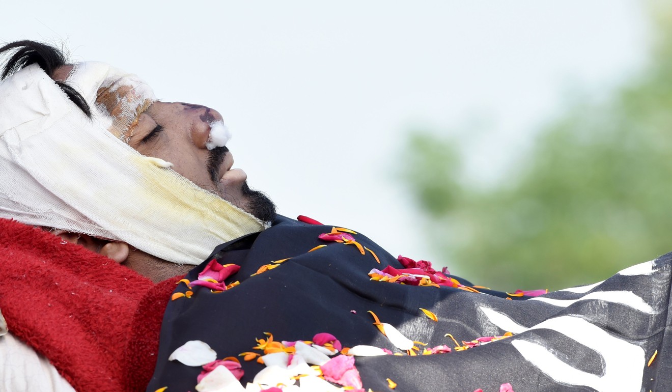 The body of Kashmiri civilian Kaiser Bhat, who was hit by an Indian paramilitary vehicle during clashes on June 1 and later died of his injuries in hospital. Photo: AFP