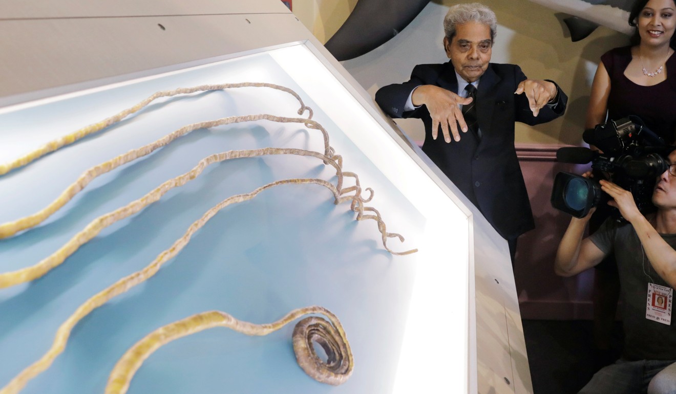 Shridhar Chillal displays his newly cut fingernails at Ripley's Believe it or Not museum in New York. Photo: Reuters