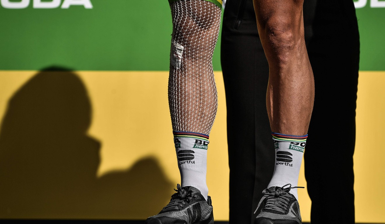 The injured right leg of best sprinter Sagan. Photo: AFP