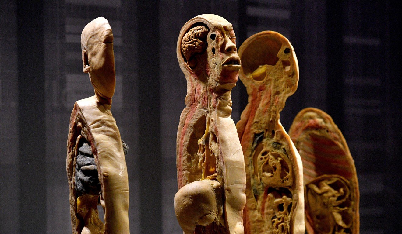 Swiss city bans display of human bodies, fearing they were ...