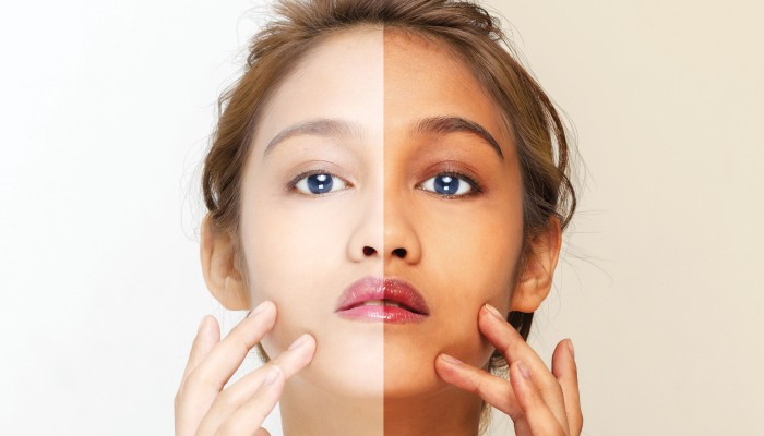 Asia S Addiction To Whiter Skin Runs Deep But The Backlash Has