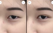 An image of reporter Viola Zhou, taken on smartphone app MakeupPlus, shows a before (left) and after comparison using the double eyelid filter. Photo: SCMP