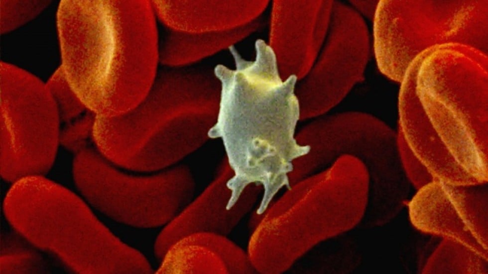 low blood cell count in dogs those with a low platelet count benefit from a healthy diet south china morning post low blood cell count in dogs those with a low platelet count benefit from a healthy diet south china morning post