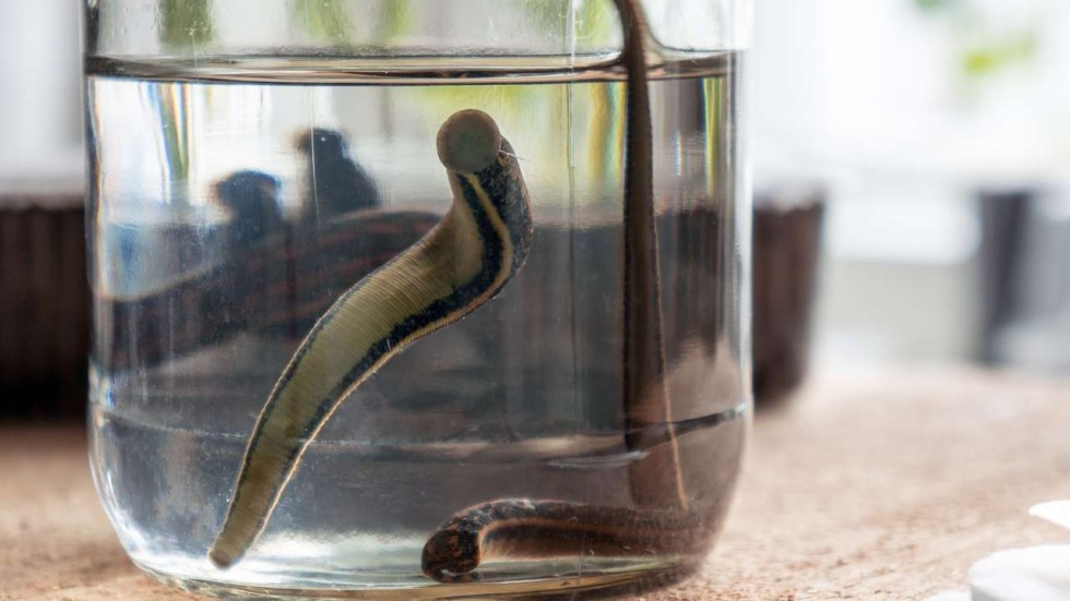 Chinese woman’s ‘bloodthirsty’ hobby of keeping leeches as pets not