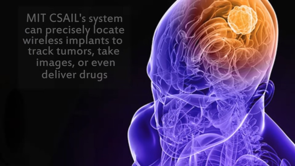 Inbody ‘GPS’ developed by MIT could track tumours and deliver pills