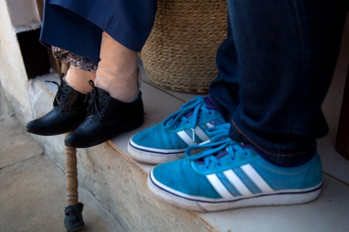 Kaki lotus dan kaki normal pada umumnya